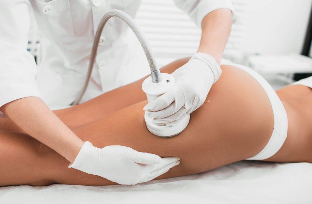 cellulite behandlung